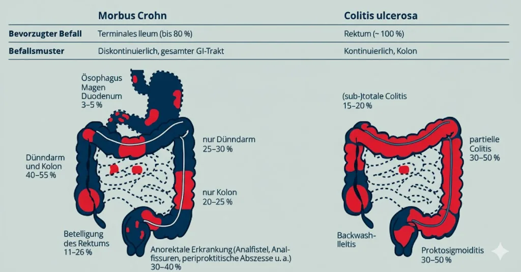 Vergleich Morbus Crohn und Colitis ulcerosa - chronisch entzündliche Darmerkrankungen die Eisenmangel verursachen können